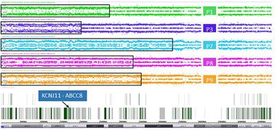 Integration of genomic analysis and transcript expression of ABCC8 and KCNJ11 in focal form of congenital hyperinsulinism